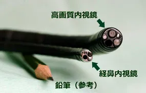 経鼻内視鏡写真