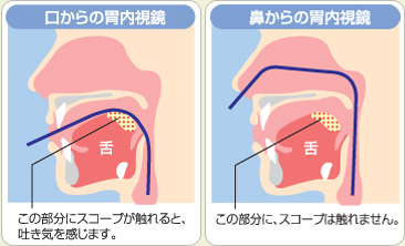 経鼻内視鏡図